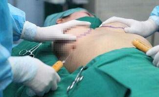 女网红做隆胸手术视频,真实体验与术后变化